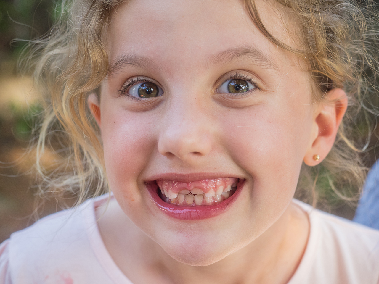 Gap between Teeth for Kids